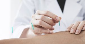 L'acupuncture pour maigrir : véritable remède ou légende