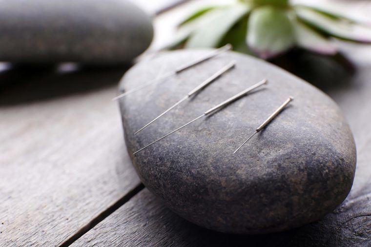 acupuncture pour maigrir