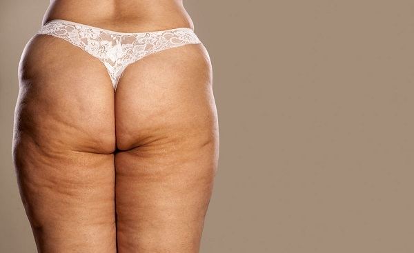 huile anti cellulite